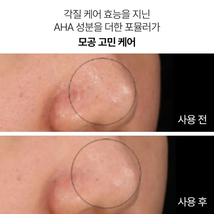 이니스프리 수퍼 화산송이 모공 마스크 80g - view 3